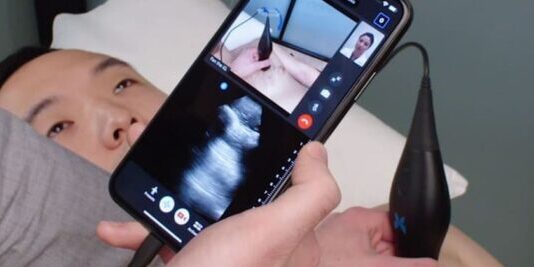 Датчик проходит быстрые тесты covid-19 для iPhone